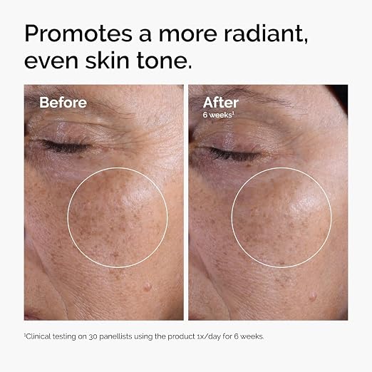 The Ordinary Glycolic Acid 7% Exfoliating Toner, Brightening and Smoothing Daily Toner for More Even-Looking Skin Tone.   (Use amazon link to purchase) #ad
